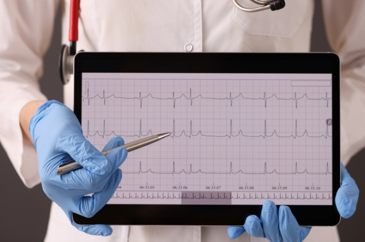 ECG